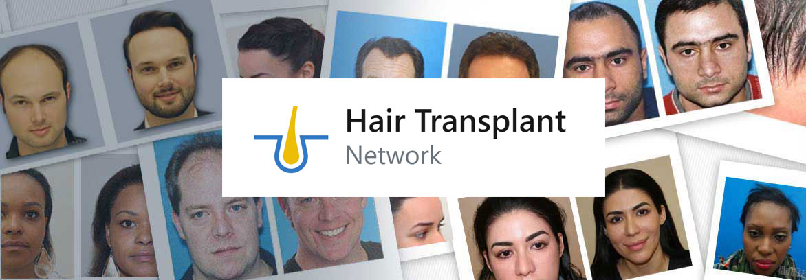 Hair Transplant Network | Where you can find pre-screened physicians as  chosen by real patients