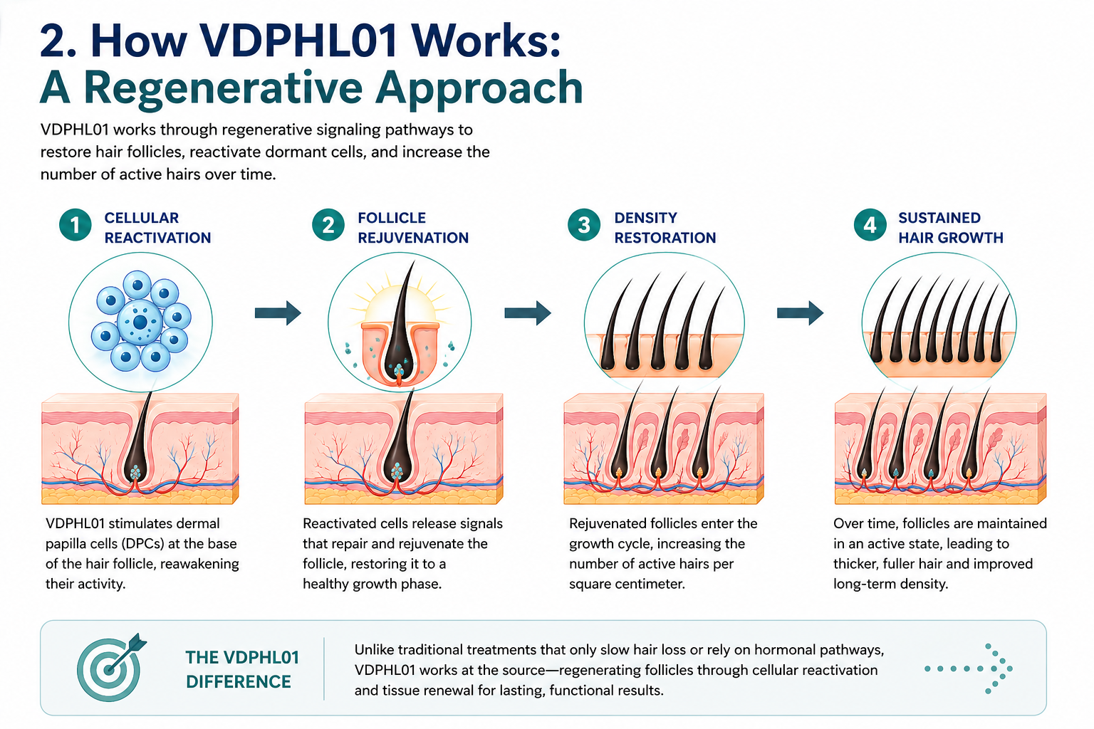 How VDPHL01 works
