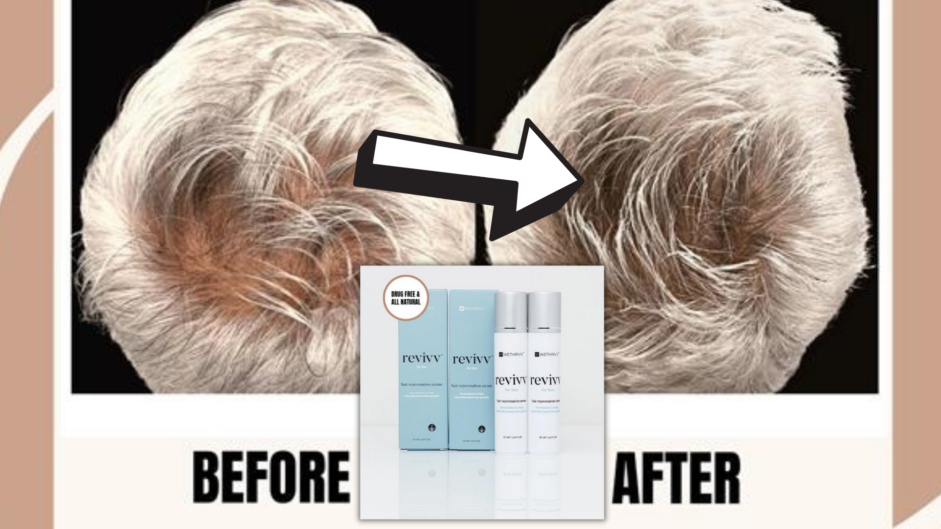 Revivv hair loss treatment