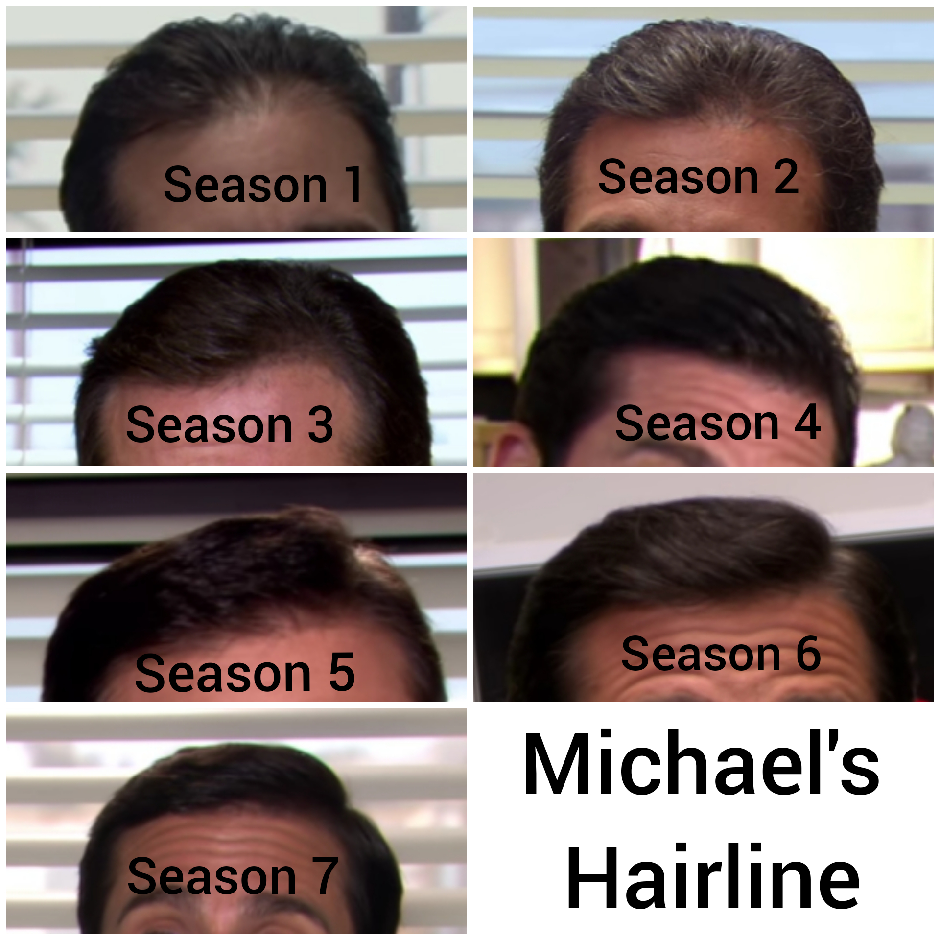 Steve's Hairline Return