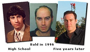 Pat hair loss to hair