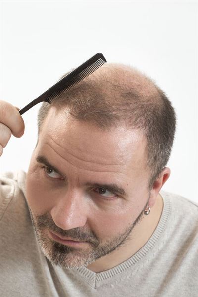 When Can You Cut Your After A Hair Transplant