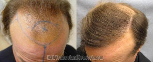 Before and after photos of  patient