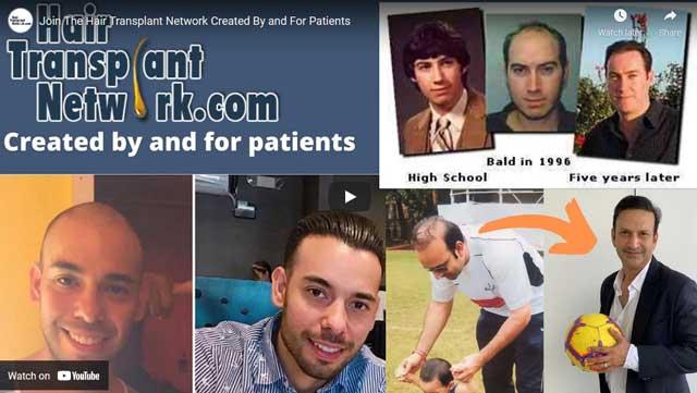 Hair Transplant Network | Where you can find pre-screened physicians as  chosen by real patients