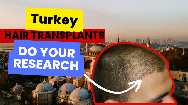 Hair Transplants in Turkey- Do Your Research