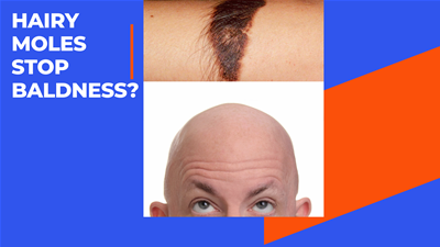 Hairy Mole Molecules May Put A Stop To Baldness