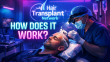 How Does A Hair Transplant Work?
