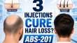 Could 3 Injections CURE Hair Loss? ABS-201 Human Trials