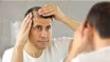Finasteride vs. Minoxidil: Which Is Best For Hair Loss?