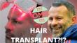 Ryan Giggs Shares His Hair Loss and Hair Transplant Journey