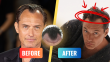 Jude Law Hair Transplant? How FUE Could Restore His Hairline — It’s the Top Choice for Celebs
