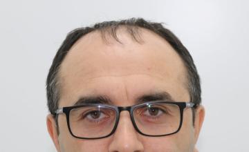 Dr Resul Yaman Hair Clinic - 4570 Grafts