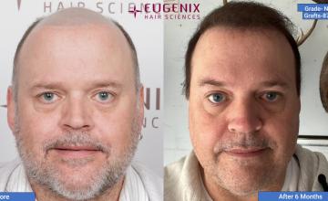 12 YEARS OF EUGENIX | EUGENIX HAIR SCIENCES | DO IT ONCE, DO IT RIGHT
