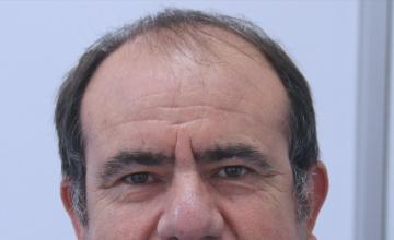 Dr Resul Yaman Hair Clinic - 4840 Grafts Result