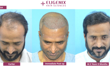 EUGENIX HAIR SCIENCE - MR. BASUDEV BHATTA