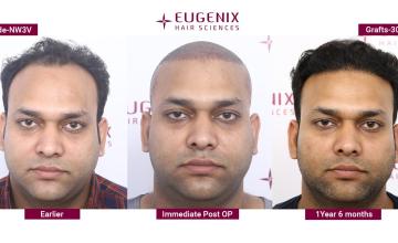EUGENIX HAIR SCIENCES | NW3V | Unlock confidence with Eugenix