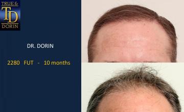 DR. DORIN -  2280 FUT 10 months out