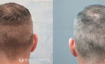 Back of patient