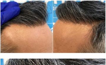 Close up of hair line