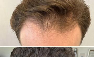 Front before and after