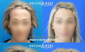 Female before and after photos