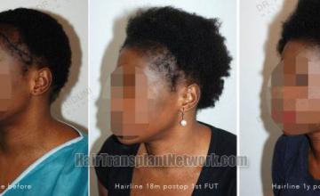 Female before and after photos