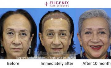 Female before and after photos