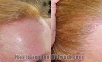 Female  before and after images