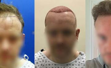 Dr. Christian Bisanga | Hair Transplant Network Dr. Christian Bisanga | Hair Transplant Network