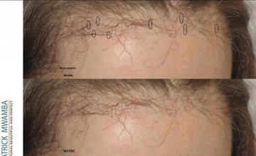 before and after photos