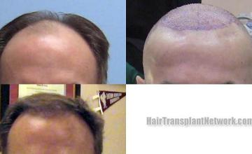   before and after images