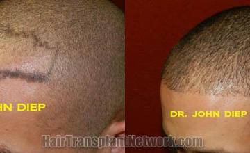  before and after photos