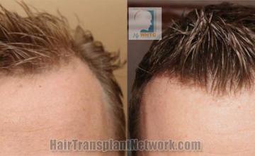 before and after images