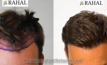 Front view - Before and after