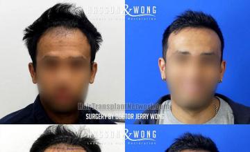 Front view - Before and after