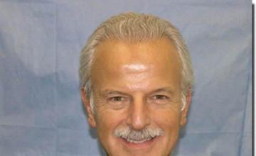 Hair restoration procedure results