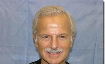 Hair restoration procedure results