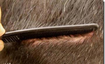 Hair restoration procedure results