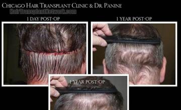  before and after photos