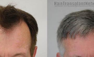 Front view - Before and after