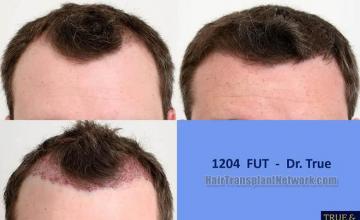   before and after photographs
