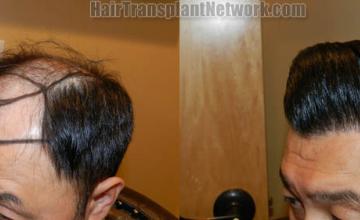  before and after photos