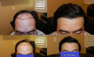 Front view - Before and after 