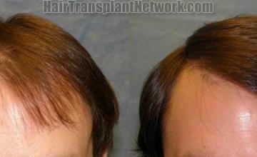  photo results - Front view