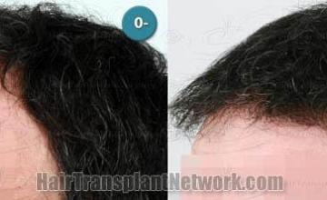  before and after images