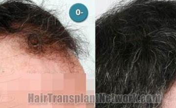  before and after photos