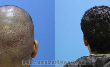  before and after result photographs