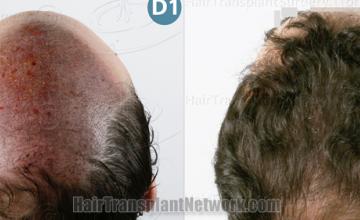  before and after result photographs