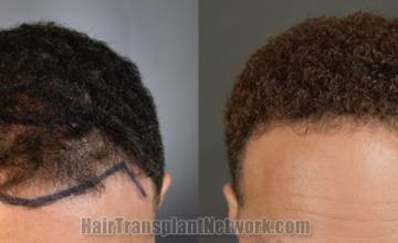 Front view - Before and after