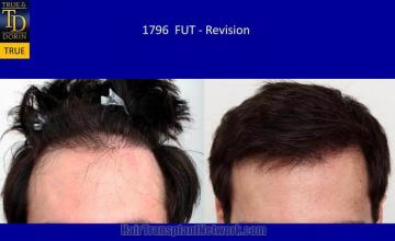Front view - Before and after